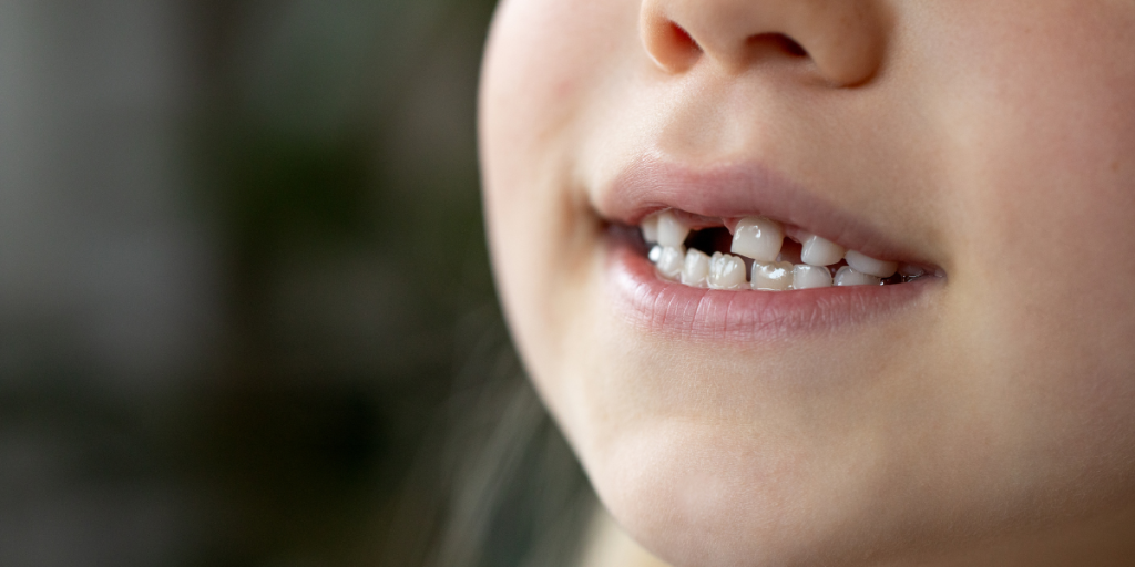 Kids dentist at Kids Corner Medical & Dental monitoring dental development and growth patterns in young patient